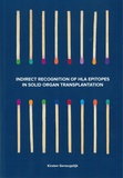 Thesis cover: Indirect recognition of HLA epitopes in solid organ transplantation