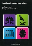 Thesis cover: Ventilator-induced lung injury