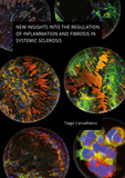 Thesis cover: New insights into the regulation of inflammation and fibrosis in systemic sclerosis